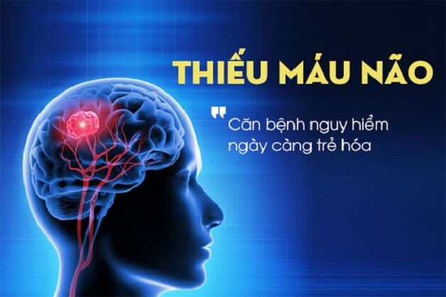 Triệu chứng và cách điều trị thiếu máu não