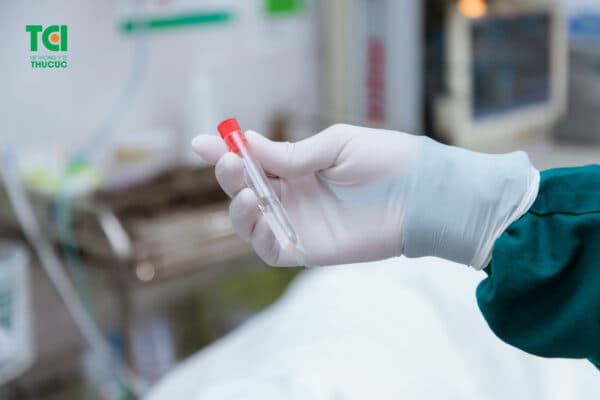 Nội soi dạ dày làm clo test 