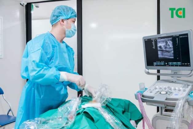 Hình ảnh bác sĩ đang hút u vú chân không