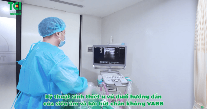 Xử đẹp hơn chục khối u vú chỉ bằng 1 đường kim siêu nhỏ