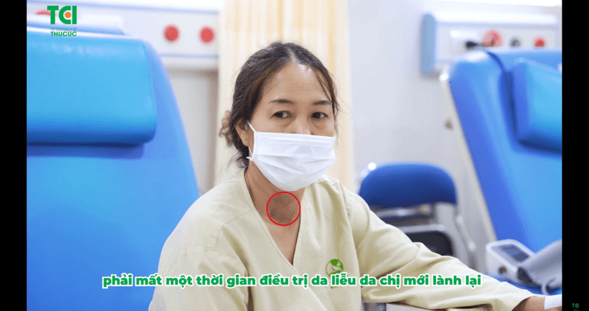 Tiền mất, tật mang vì chữa u tuyến giáp theo lời thầy lang