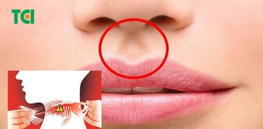 Giải thích tin đồn bấm huyệt chữa hóc xương cá