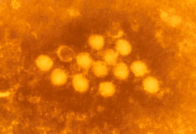 Coxsackievirus (A16) - nguyên nhân phát sinh bệnh tay chân miệng.