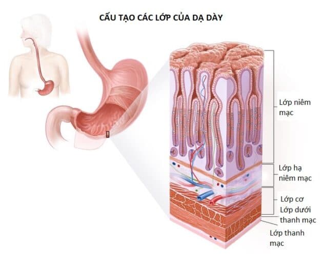 Các giai đoạn ung thư dạ dày tiến triển như thế nào