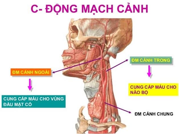 cập nhật điều trị nhồi máu não sau chấn thương động mạch cảnh