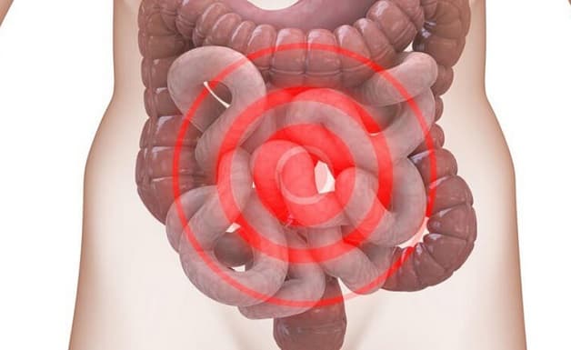 Co thắt đại tràng ở trẻ em là bệnh xảy ra khi có rối loạn ở trong hệ tiêu hóa