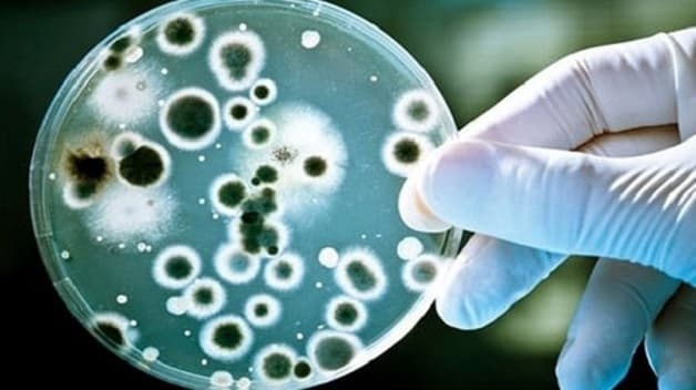 Bệnh co thắt đại tràng có thể do nhiều nguyên nhân khác nhau gây ra trong đó có nhiễm khuẩn