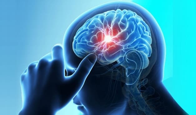 dự phòng sa sút trí tuệ nên thực hiện từ sớm