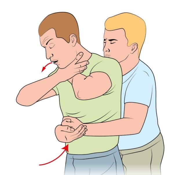 Hóc dị vật vào phổi