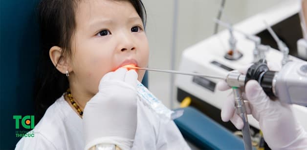 Hóc xương cá nên ăn gì