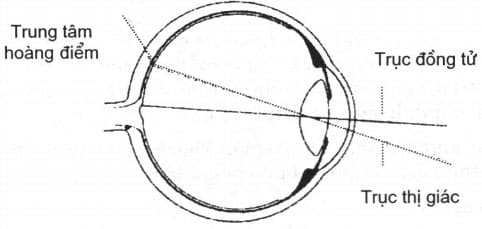 Khám bằng phương pháp Krimky