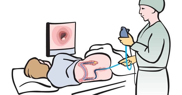 Nội soi là phương pháp chẩn đoán bệnh chính xác