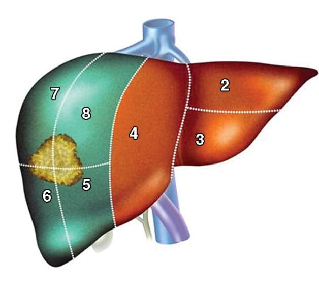 Các phương pháp điển hình trong điều trị ung thư gan