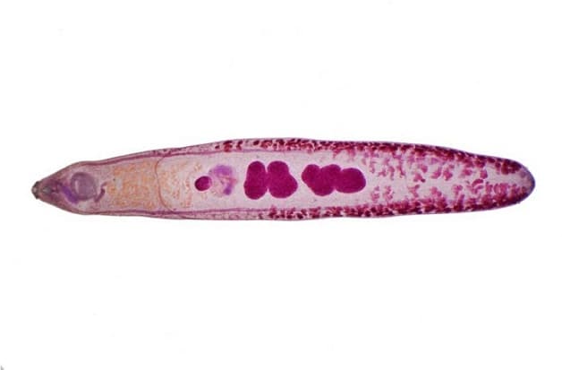 Sán lá gan nhỏ là bệnh truyền nhiễm, có thể gây nhiều biến chứng nguy hiểm.