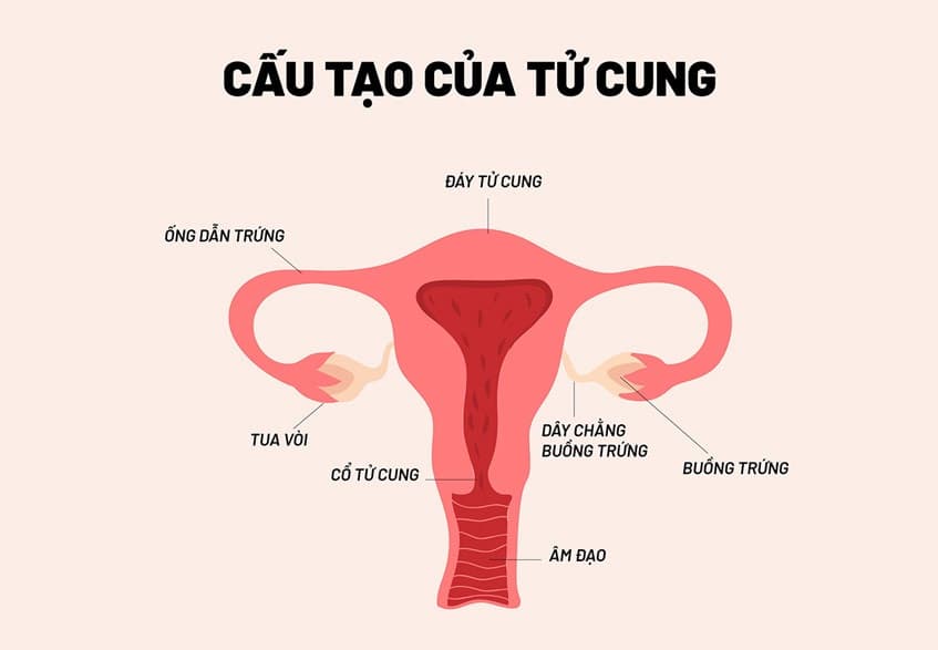 U xơ đáy tử cung là u xơ xuất hiện và phát triển ở vị trí đáy tử cung