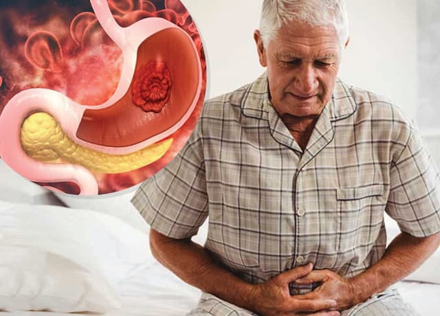 Ung thư dạ dày: Các giai đoạn và dấu hiệu nhận biết