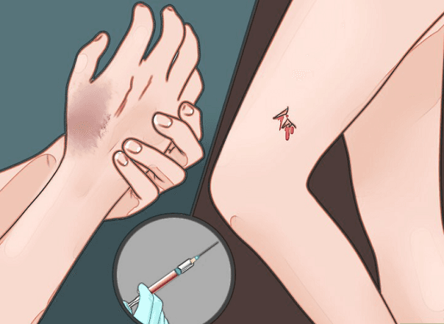 Bệnh uốn ván có chữa được không phụ thuộc vào nhiều yếu tố.