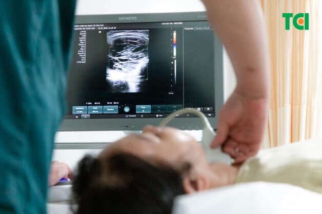Hình ảnh khối u tuyến giáp hiển thị khi siêu âm (Ảnh: TCI)