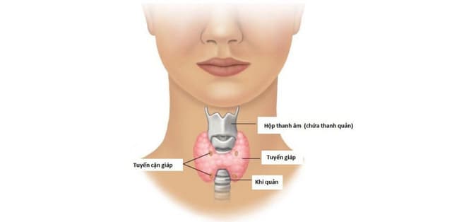 Cắt 2 thùy tuyến giáp có gây nguy hiểm đến sức khỏe không?