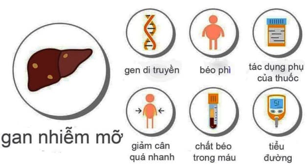 bệnh gan nhiễm mỡ có nguy hiểm