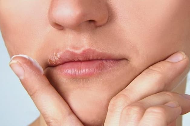 bệnh herpes có chữa khỏi được không