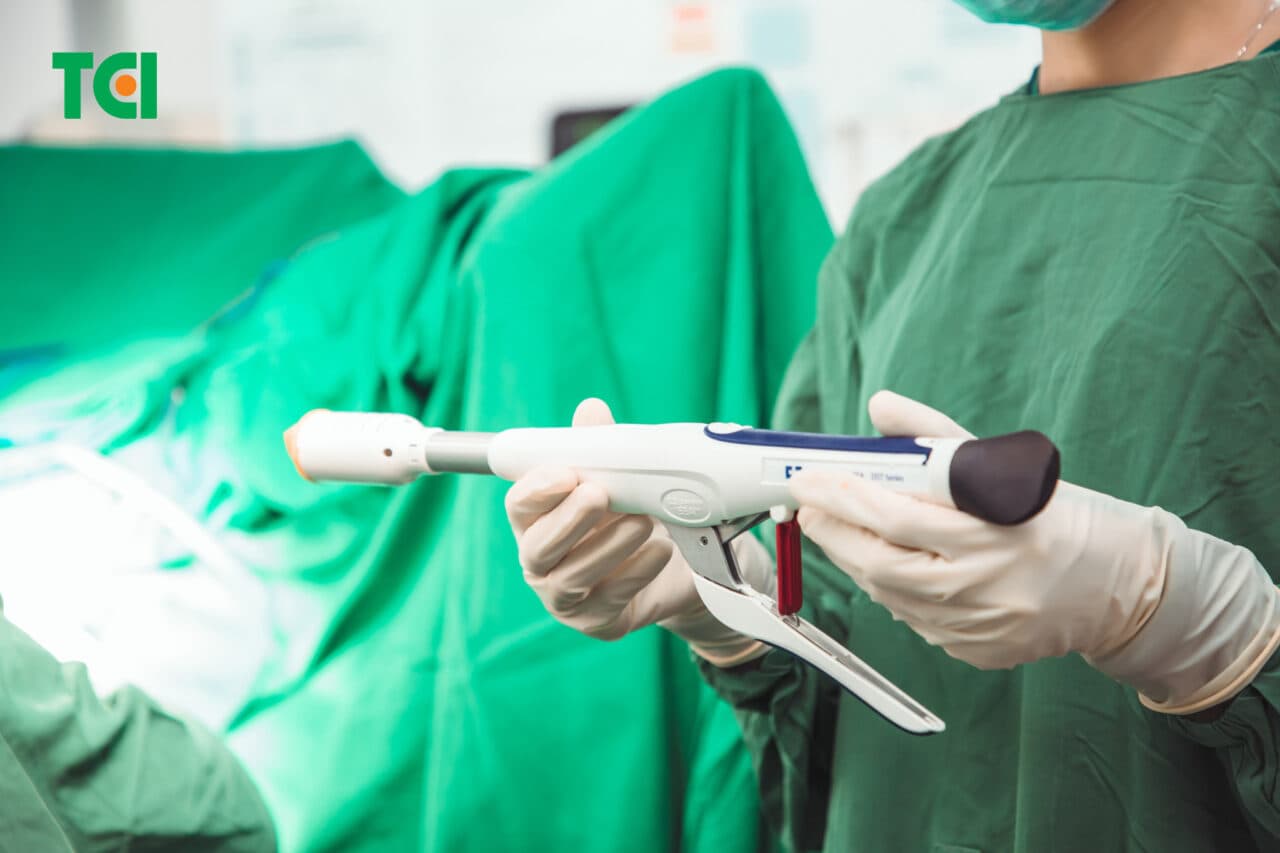 Phẫu thuật cắt trĩ Longo được ưa chuộng