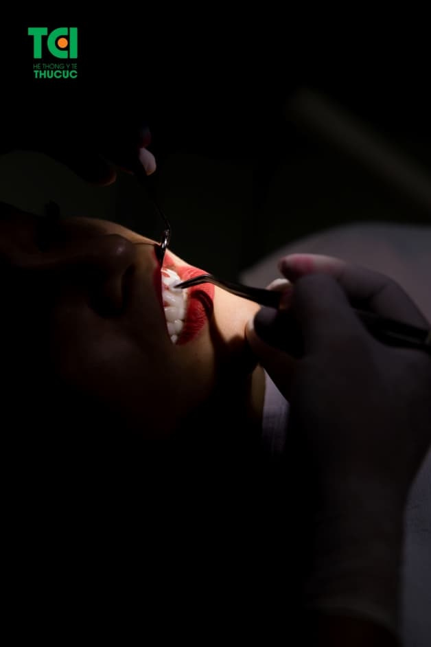 bọc răng sứ giá rẻ