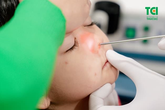 cách lấy dị vật ra khỏi mũi