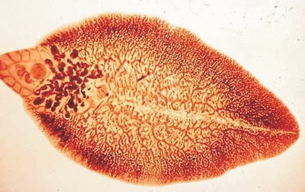 Đặc điểm sán lá gan về hình dạng 