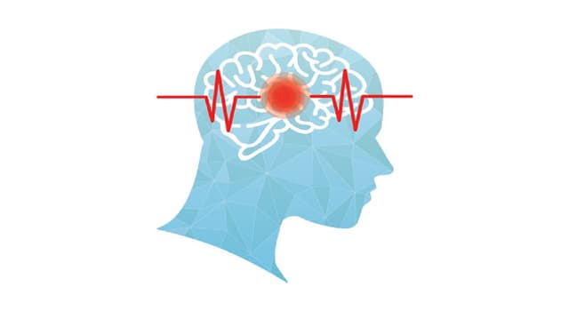 Những nhóm nguy cơ bị đột quỵ cao