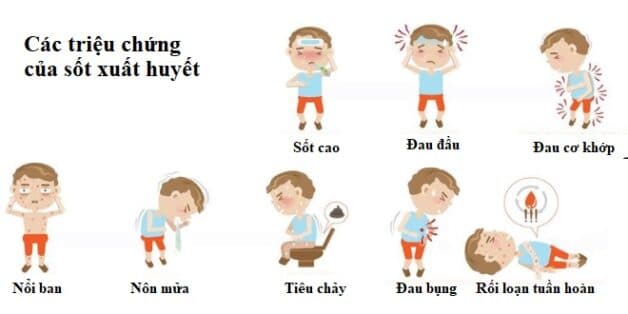 Các triệu chứng thể nhẹ của sốt xuất huyết