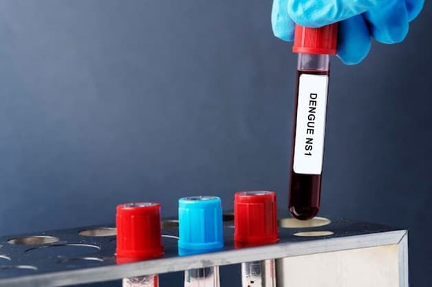 xét nghiệm chẩn đoán virus sốt xuất huyết. 