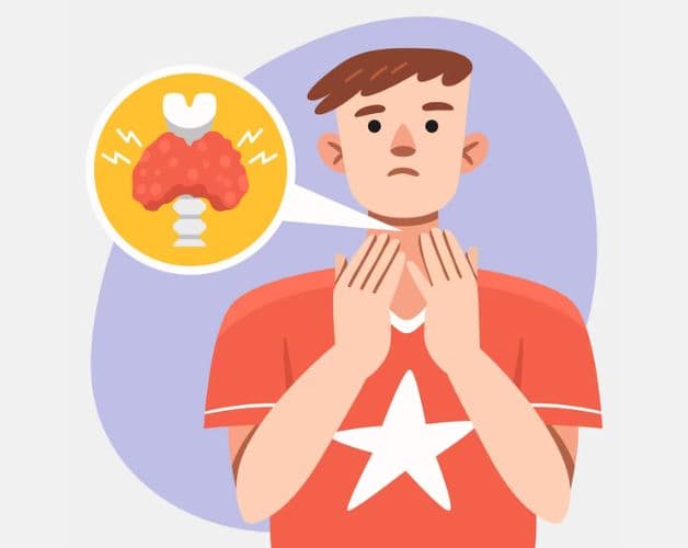 Bướu giáp đa nhân gây nhiều phiền toái cho người bệnh