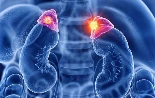 Hình ảnh u tuyến thượng thận hai bên