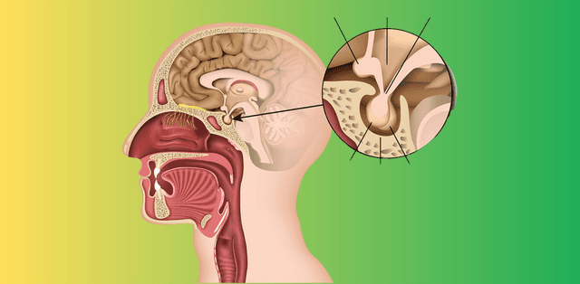 Nguyên nhân u tuyến yên bệnh học