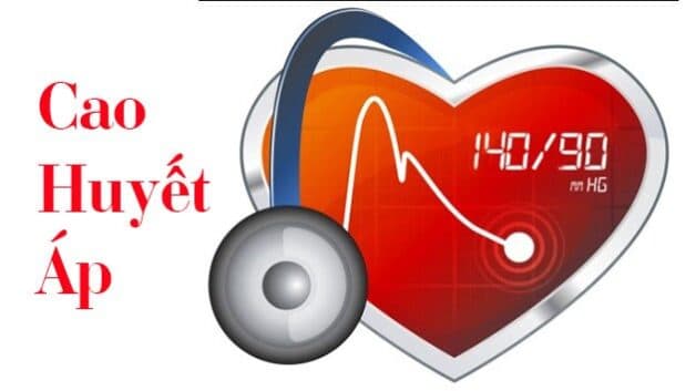 đột quỵ và béo phì