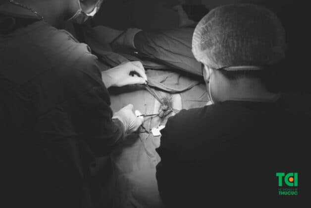 Hình ảnh búi trĩ sưng to trong ca phẫu thuật