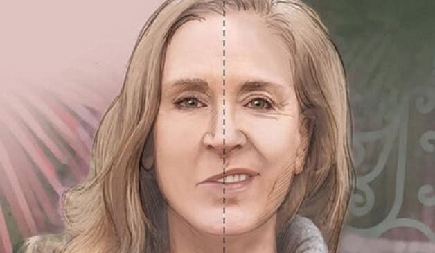 Đột quỵ biểu hiện ra sao?