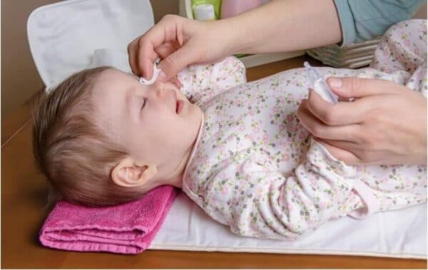 Vệ sinh mắt cho trẻ