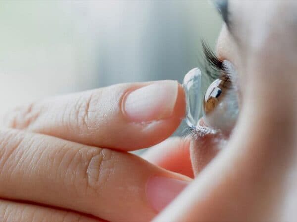 Mắt đỏ do kích ứng từ việc sử dụng kính áp tròng