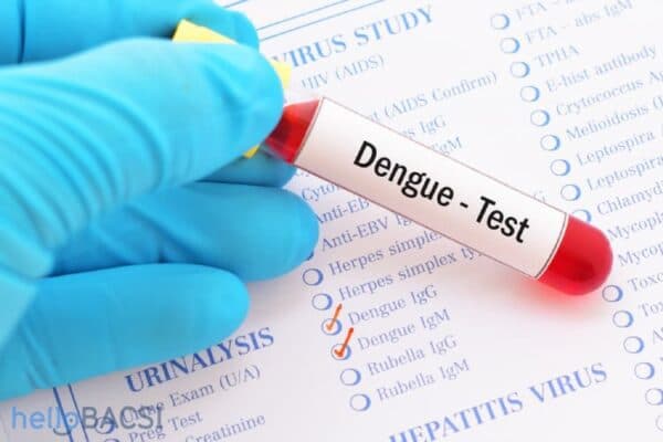 Những xét nghiệm mắc sốt xuất huyết