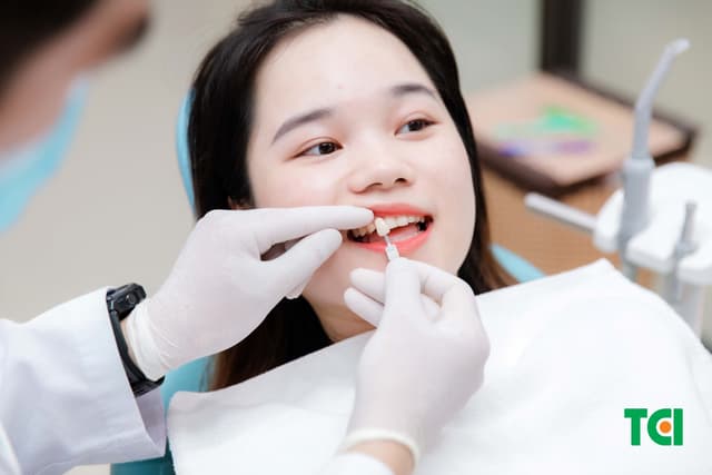 Chọn lựa giữa trám và bọc răng sứ khi bị sâu răng