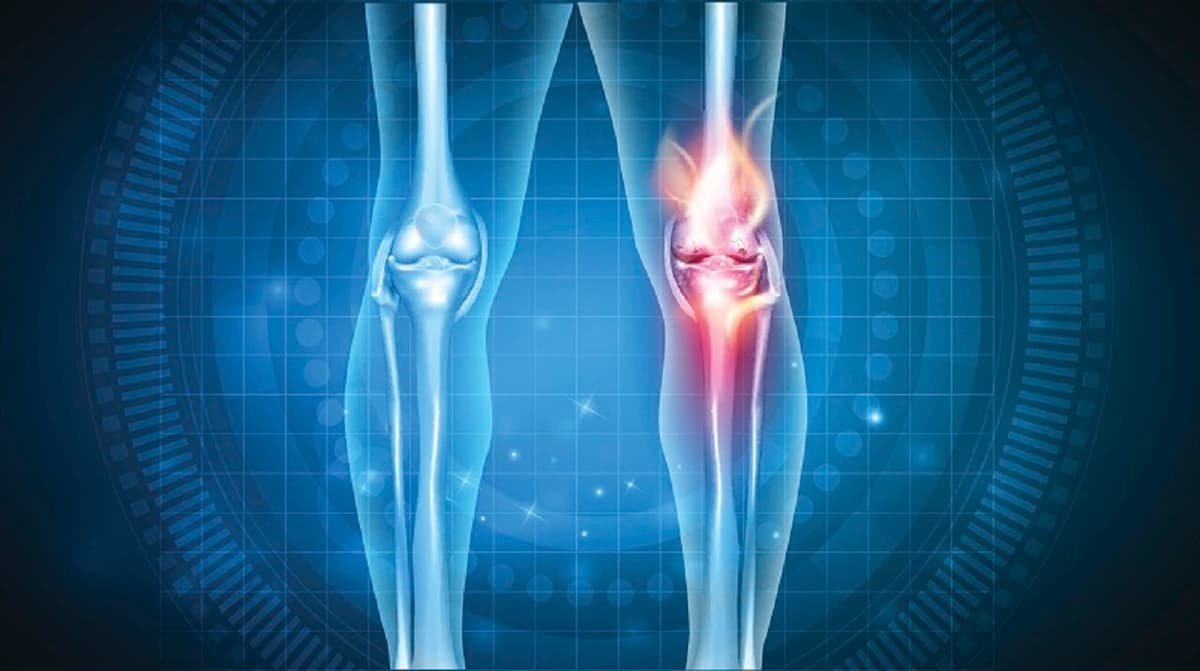 Triệu chứng viêm khớp nhiễm khuẩn bạn cần biết