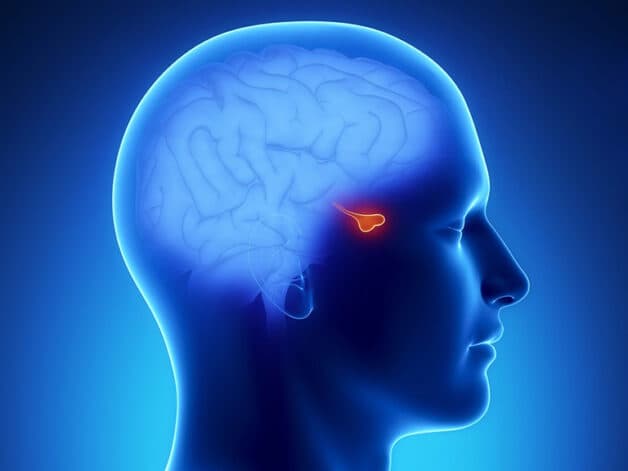 U tuyến yên là sự tăng trưởng bất thường của tuyến yên