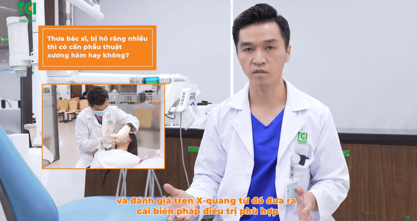 Răng hô nhiều có cần phẫu thuật để cải thiện không?