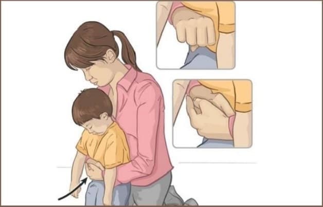 cách lấy xương bị hóc