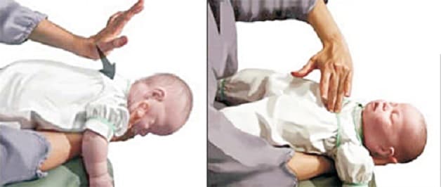 Cách xử lý hóc dị vật đường thở