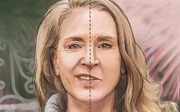 Điều trị phục hồi cho bệnh nhân bị đột quỵ méo miệng khó nói