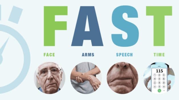 Hiểu về giờ vàng cấp cứu trong tai biến mạch máu não