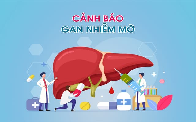 Các dấu hiệu cảnh báo bệnh lý gan nhiễm mỡ đừng bỏ qua